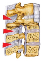 <p>stabilizes spinal process. limits spinal flexion</p>