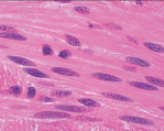 <p>What muscle is this?</p>