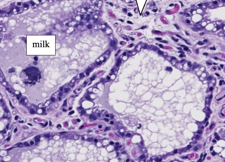 <p>what CT is the white arrow pointing to?</p>