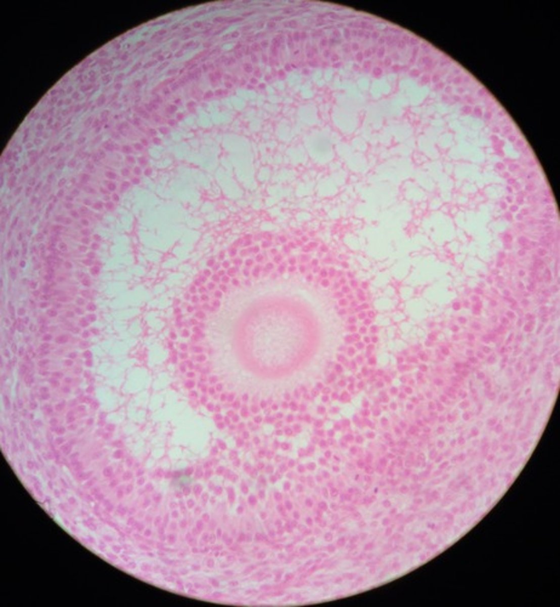 <p>Contains maturing ovum and ruptures during ovulation</p>