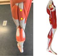 <p>Medial side</p>