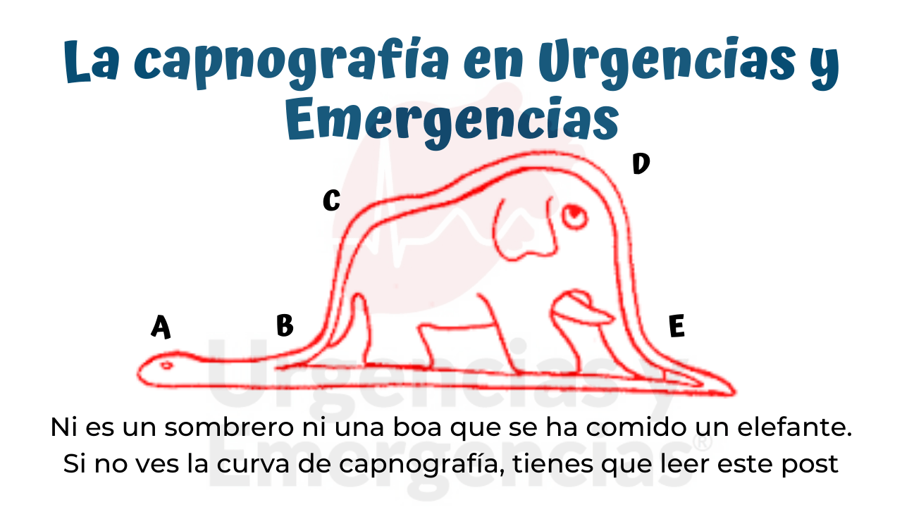 <p><span><span>Capnografía (presencia de onda de EtCO2)</span></span></p>