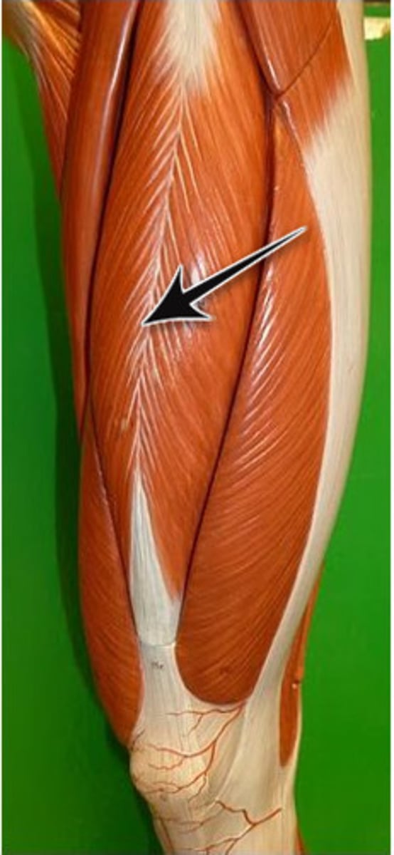 <p>Part of the quadriceps group</p><p>Action - extends leg at the knee</p>