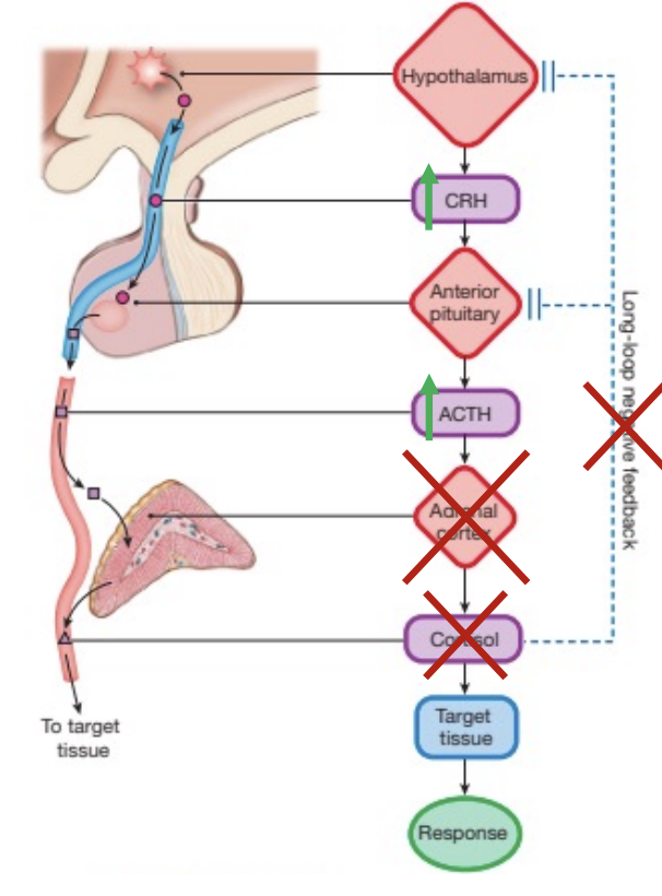 <p>Too little presence of a hormone, causes a stop to hormone pathways.</p><p>Can be caused by atrophy of <strong>endocrine glands</strong>.</p>