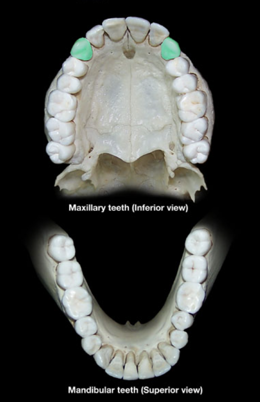 term image
