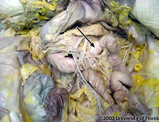 <p>what structure is pictured (be specfic; context: transverse colon and stomach have been reflected)?</p>