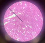 <p>Location: Heart</p><p>Function: <span style="background-color: transparent;">pumps blood throughout the body, delivering oxygen & nutrients while removing metabolic waste</span></p><p><span style="background-color: transparent;">Muscular Tissue</span></p>
