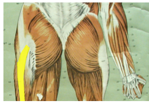 <p>What is the highlighted muscle?</p>