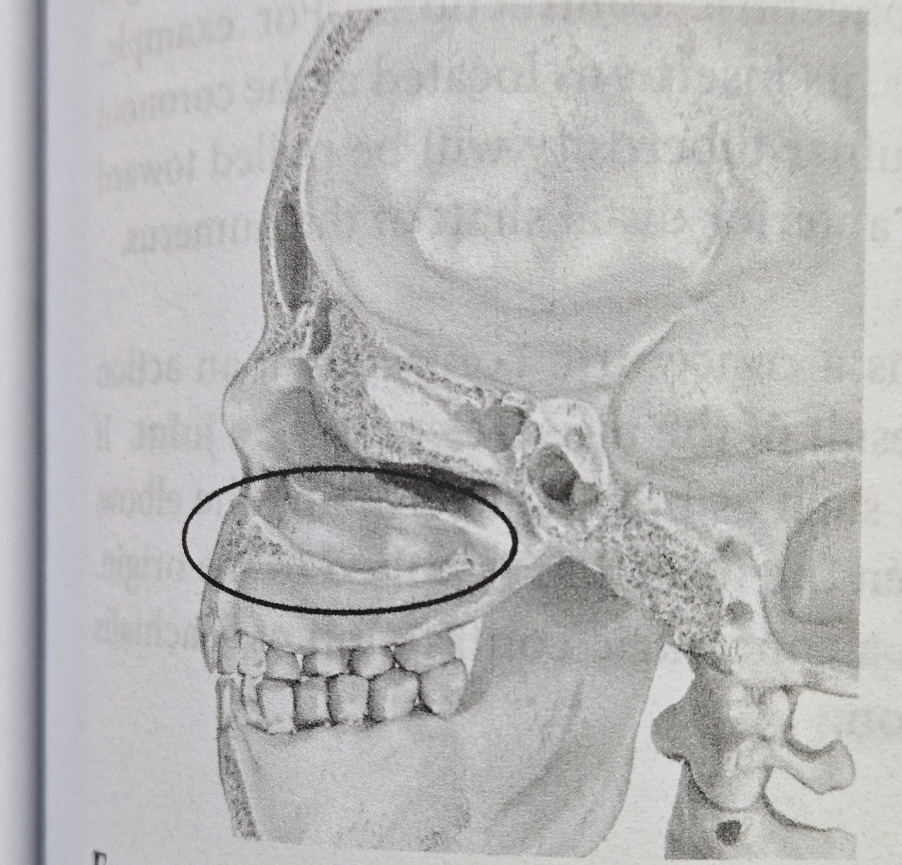 <p>Sinus</p>