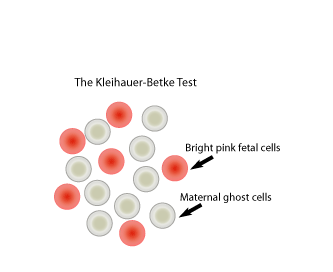 <p>Maternal RBC > pale </p><p>Fetal RBC > pink / bright red </p>