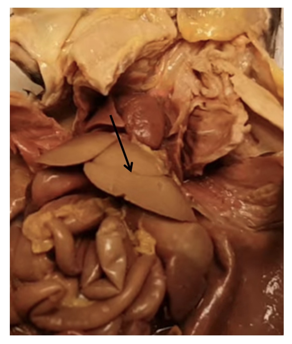 <p>name the organ at the arrow tip</p>