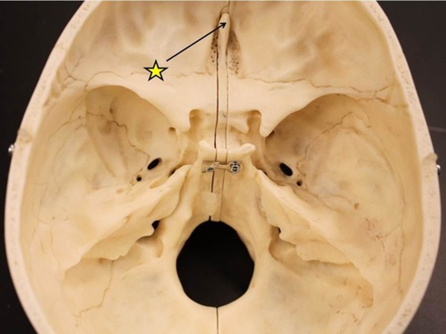 <p>ID structure at tip of arrow</p>
