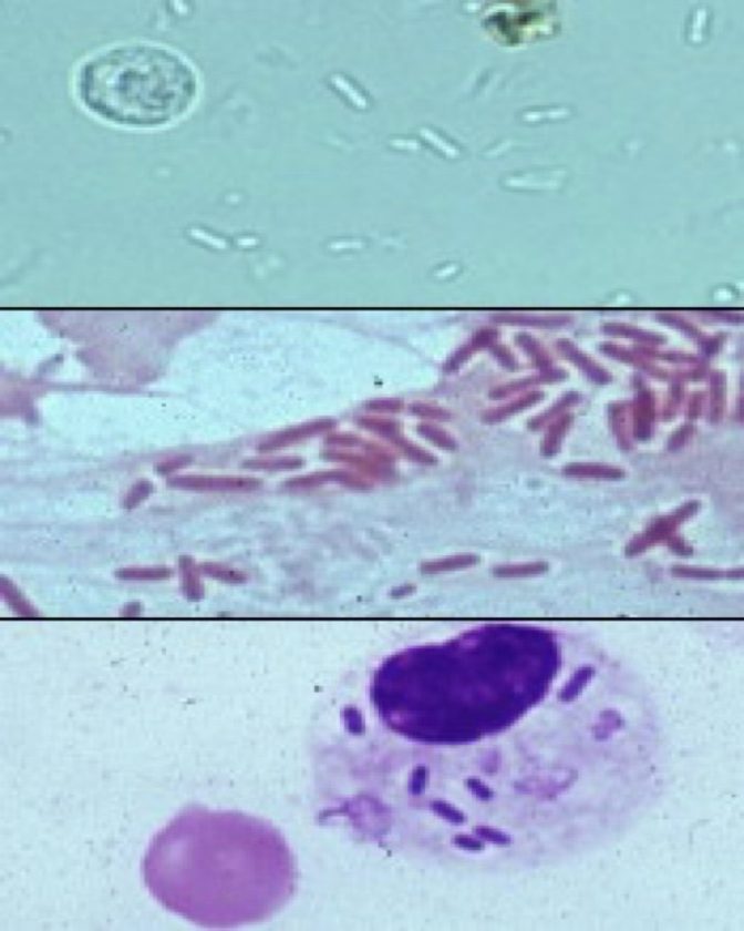 <ul><li><p>Can only be identified under the 40x high power objective.</p><ul><li><p>May appear to be quivering- Brownian’s movement.</p></li></ul></li><li><p>Large # accompanied by WBC’s can indicate infection/ inflammation of the urinary or genital tract.</p></li></ul><p></p>