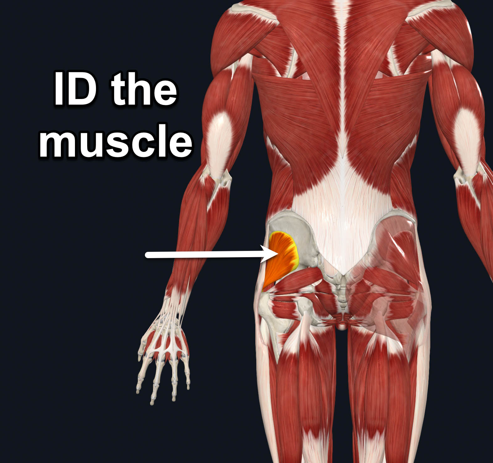 term image