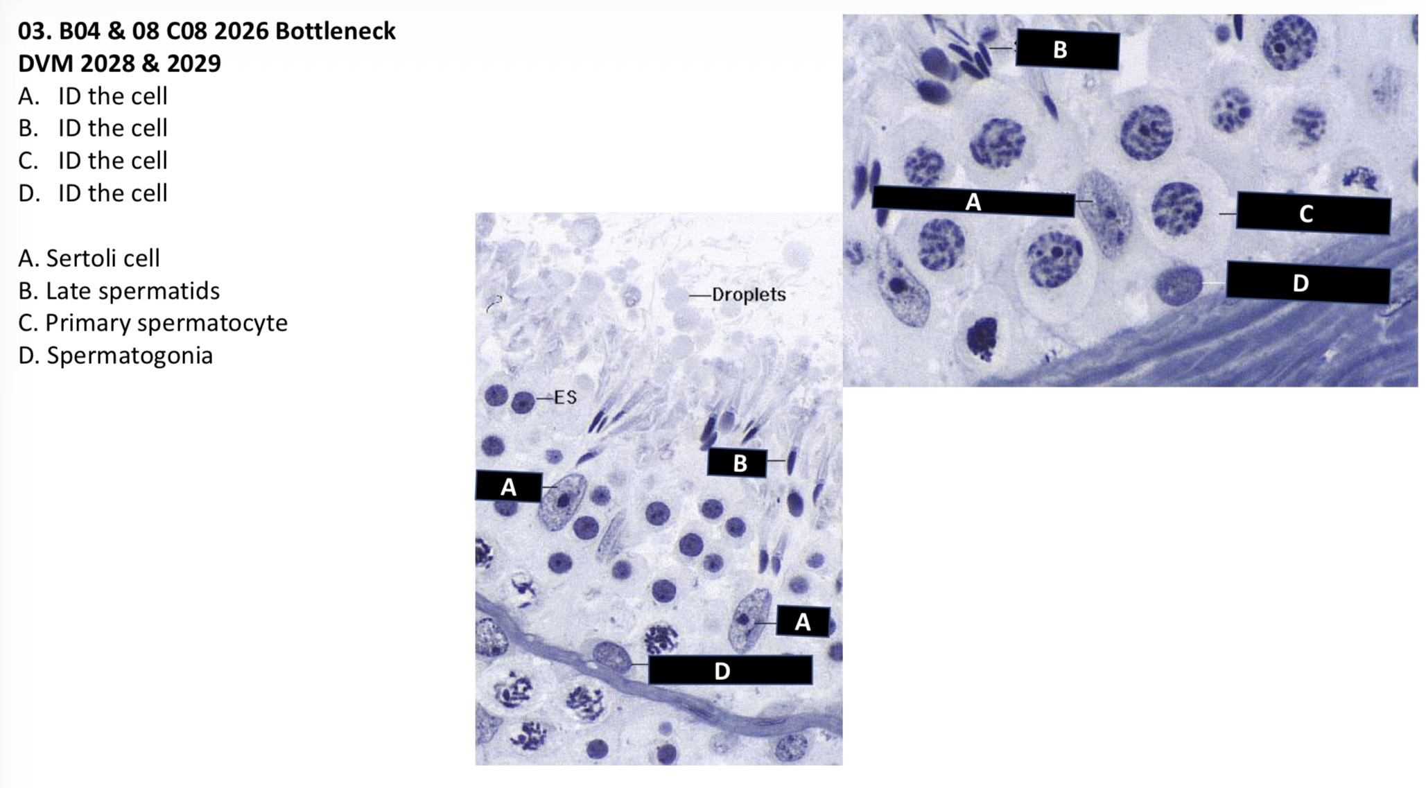 <p>A. Sertoli cell</p><p>B. Late spermatid</p><p>C. Primary spermatocyte</p><p>D. Spermatogonia</p>