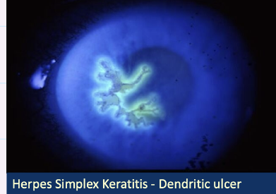 <p>Describe this image and give diagnosis?</p>