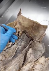 <p>Name the muscle</p><p>- middle layer</p><p>- most lateral capitis of spinalis and semispinalis</p>