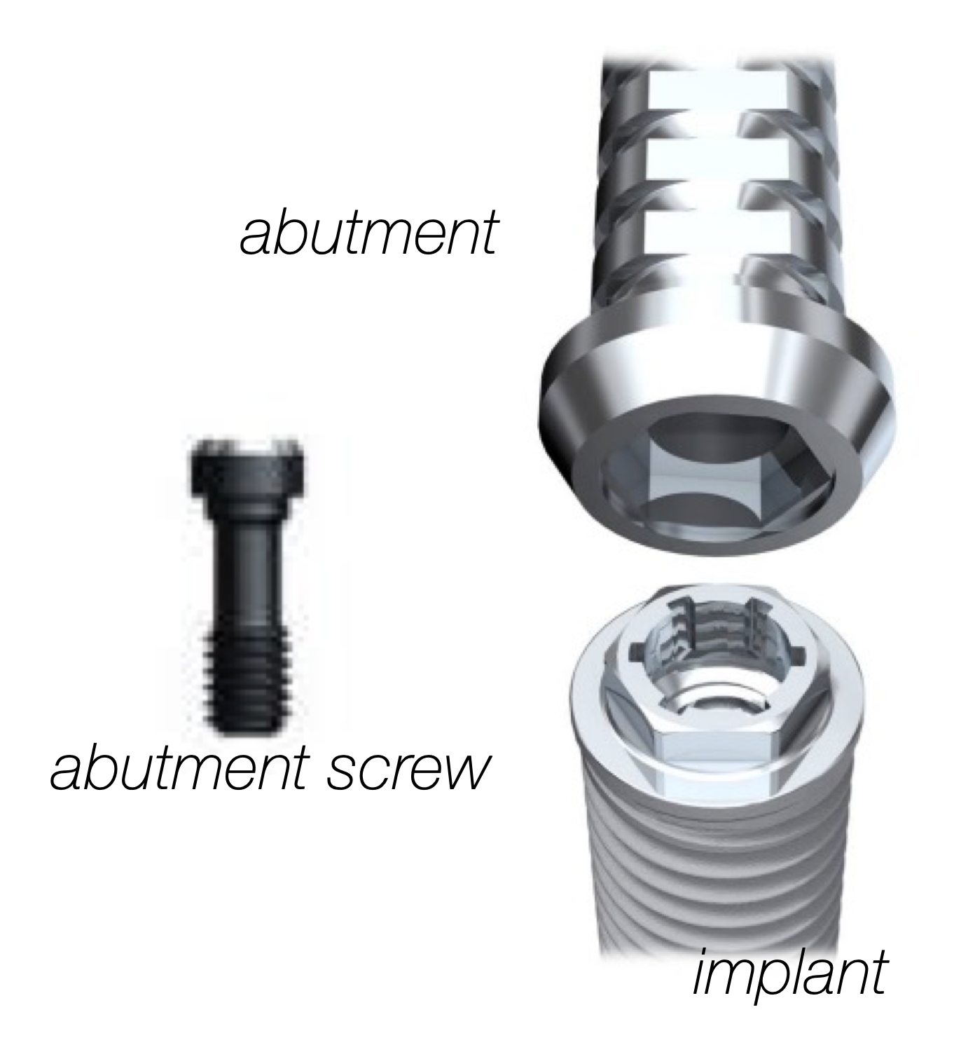 <p>External abutment connection interface</p>