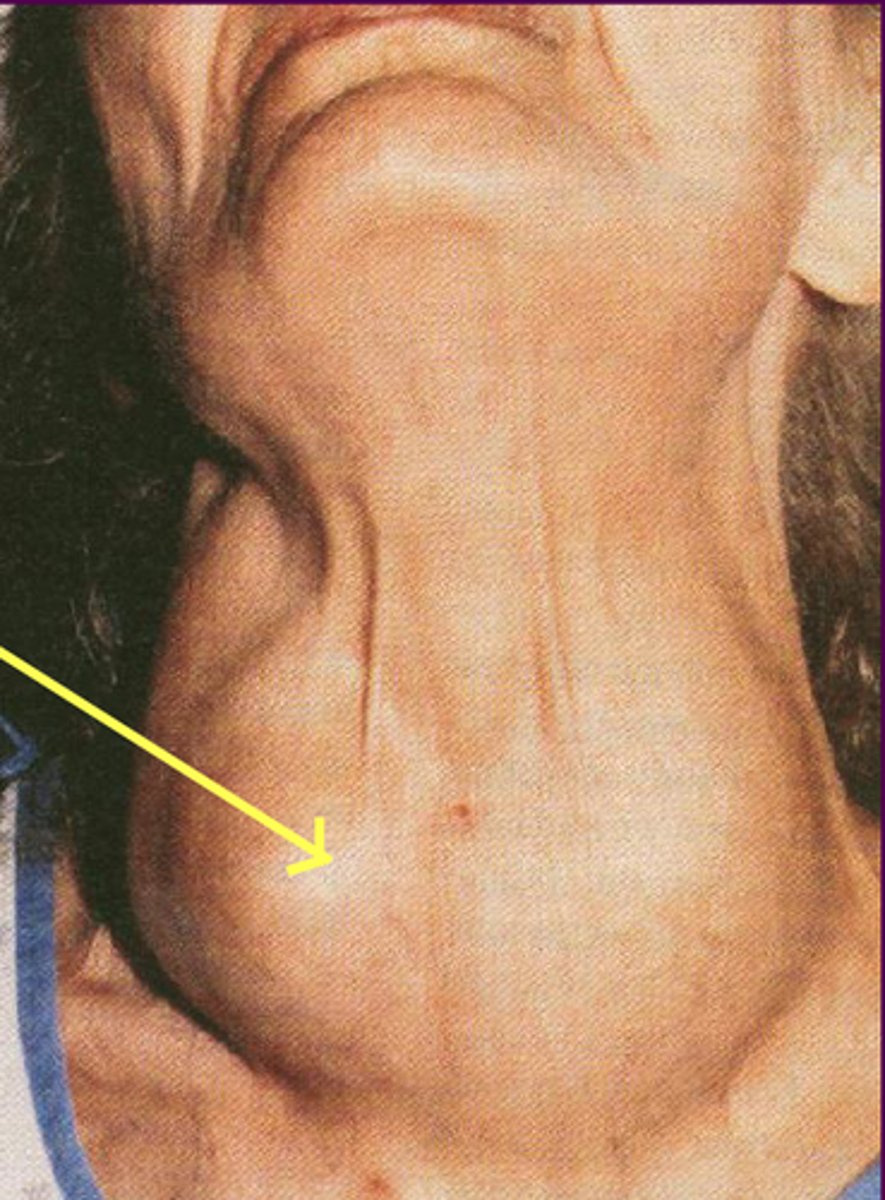 <p>An enlarged thyroid gland and an anti-allergic hormone that reduces stress.</p>