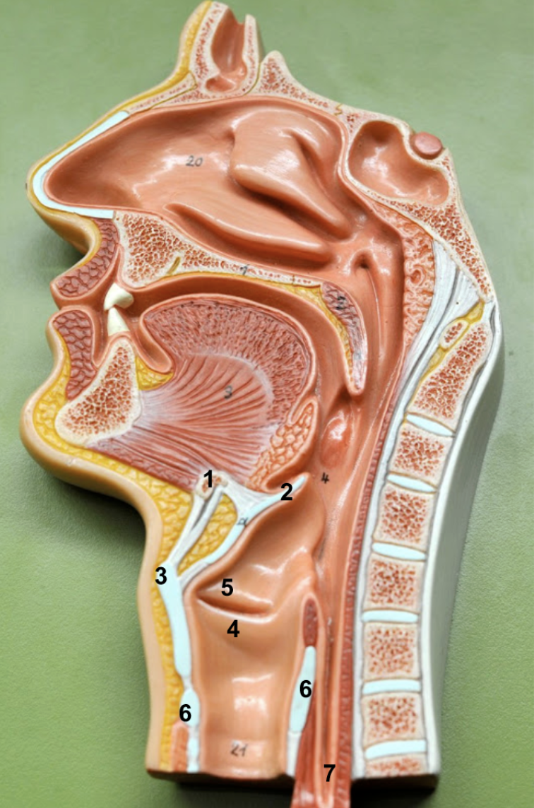 <p>- Sound production comes from the larynx (it is our voicebox), which this image depicts. As air moves in and out sound is created.</p><ol><li><p>Hyoid bone</p></li><li><p>Epiglottis: Helps prevent choking. Opens when breathing, closes when swallowing food. </p></li><li><p>Thyroid cartilage (largest laryngeal cartilage)</p></li><li><p>True vocal cords - vibrate when air rushes past to produce sound. It is called true bc it <u>has</u> muscle. </p></li><li><p>False vocal cords - protect the vocal folds (true vocal chords). It is called false bc it <u>lacks</u> muscle.</p></li><li><p>Cricoid cartilage (visible in both the anterior and posterior larynx)</p></li><li><p>Esophagus</p></li></ol><p></p>