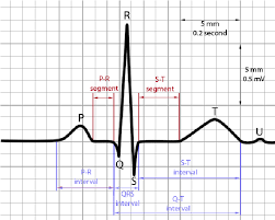 <p>Ventricles repolarizing (relaxing)</p>