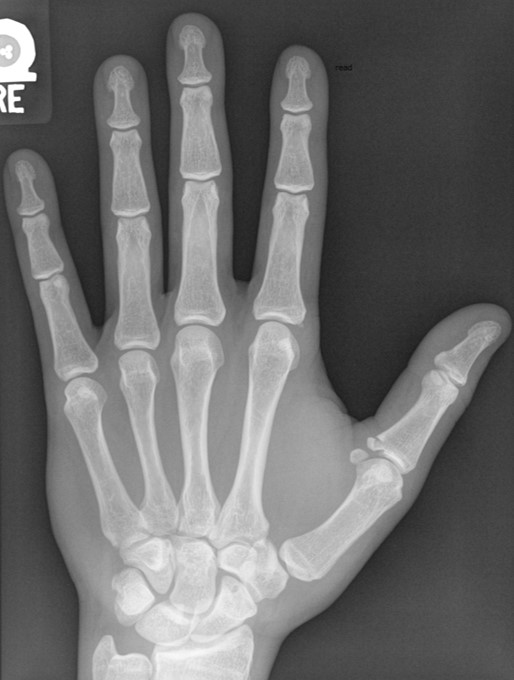 <p>What is the diagnosis?</p>