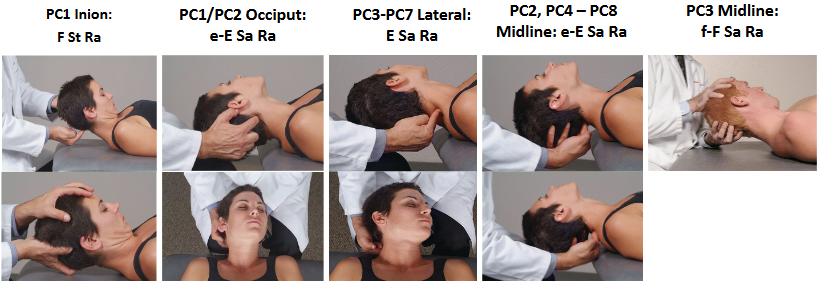 <ul><li><p>occiput → e-E Sa Ra</p></li><li><p>midline spinous process → e-E Sa Ra</p></li><li><p>periorbital/temporal headache</p></li></ul><p></p>