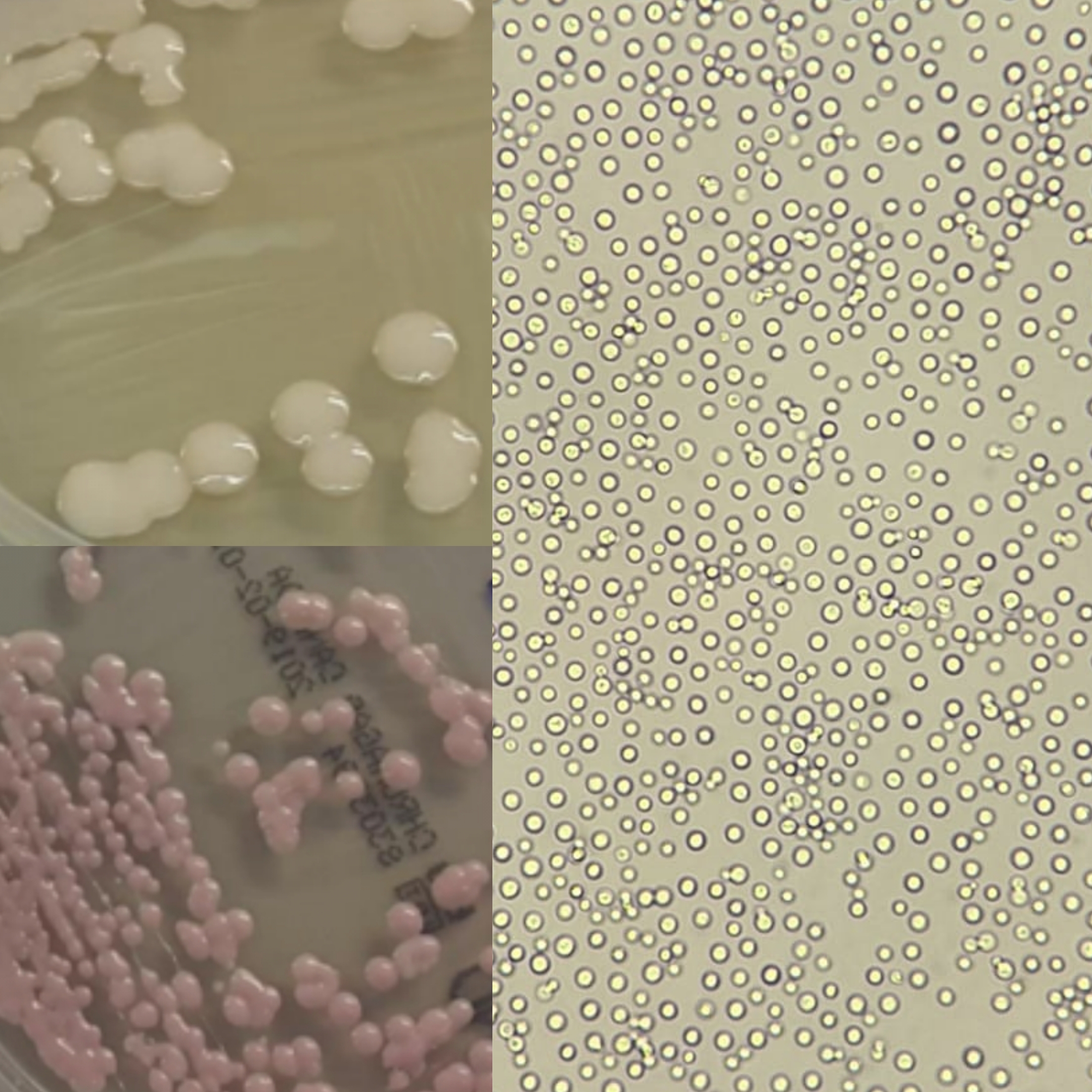<p>Identifica a levedura pelos resultados nas provas de identificação:</p><p class="has-focus">Prova dos clamidosporos: -</p><p class="has-focus">Prova da filamentaçao: -</p><p class="has-focus">Prova dos ascosporos: -</p><p class="has-focus">Prova da urease: +</p><p class="has-focus">Prova da fenoloxidase: +</p><p class="has-focus">Sensibilidade à cicloheximida: -</p><p class="has-focus">Cor no meio de chromagar Cândida: rosa acinzentado</p><p class="has-focus">Análise macroscopica: colónias com aspeto mucóide, convexas com bordos regulares</p>