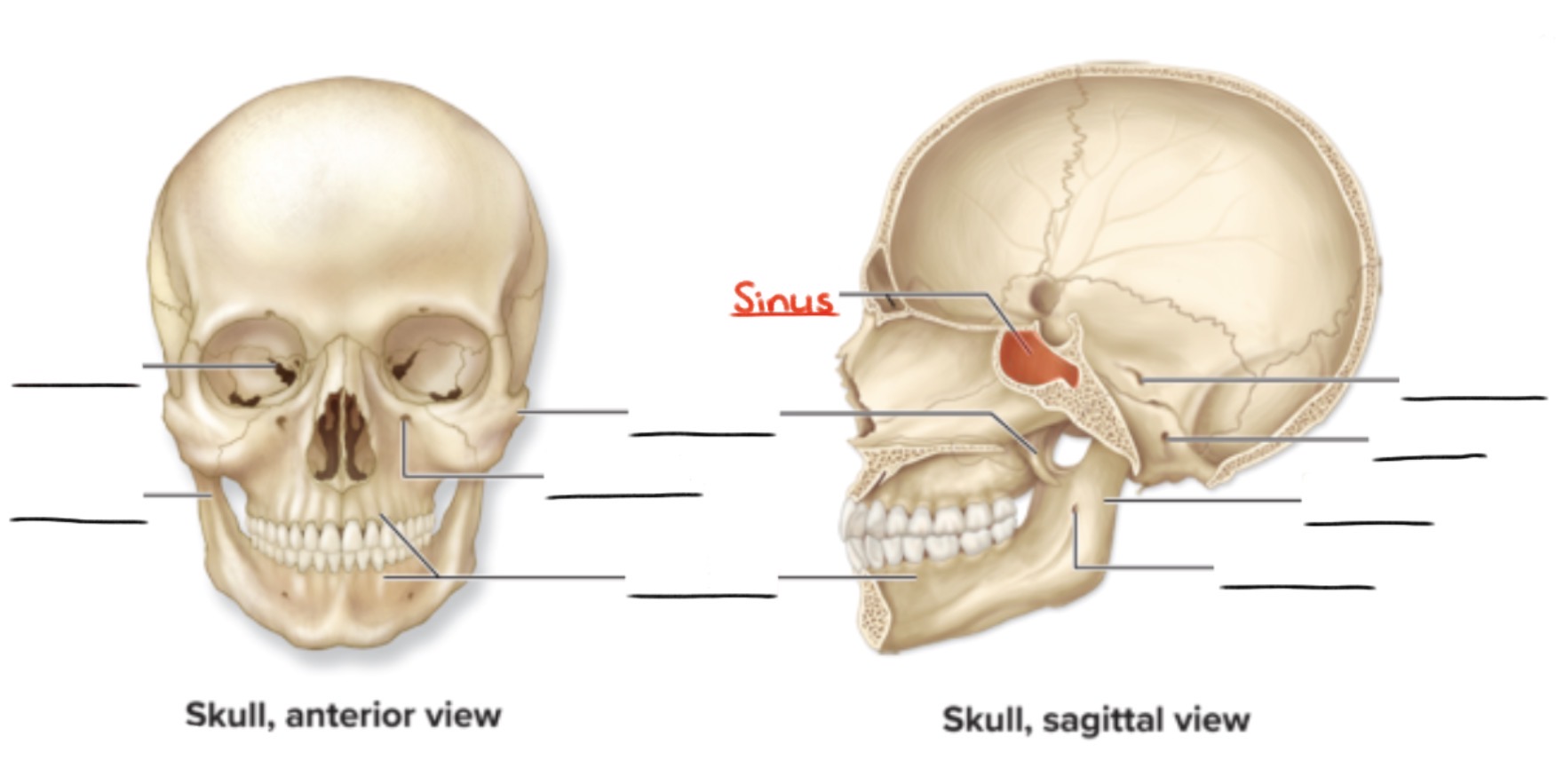 <p><strong>Sinus</strong></p><p>Cavity or hollow space in a bone</p><p>(Openings and spaces)</p>