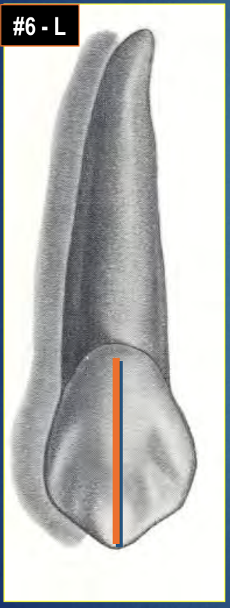 <p>What is the name of the indicated structure? </p>