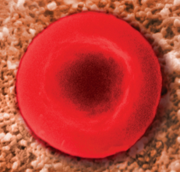 <p>causes no change in cell volume</p><ul><li><p>same concentration of nonpermeating solutes in extra and intracellular fluid</p></li><li><p>ex. saline</p></li></ul><p></p>