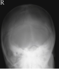 <p><span style="background-color: transparent;">Towne - Skull</span></p>