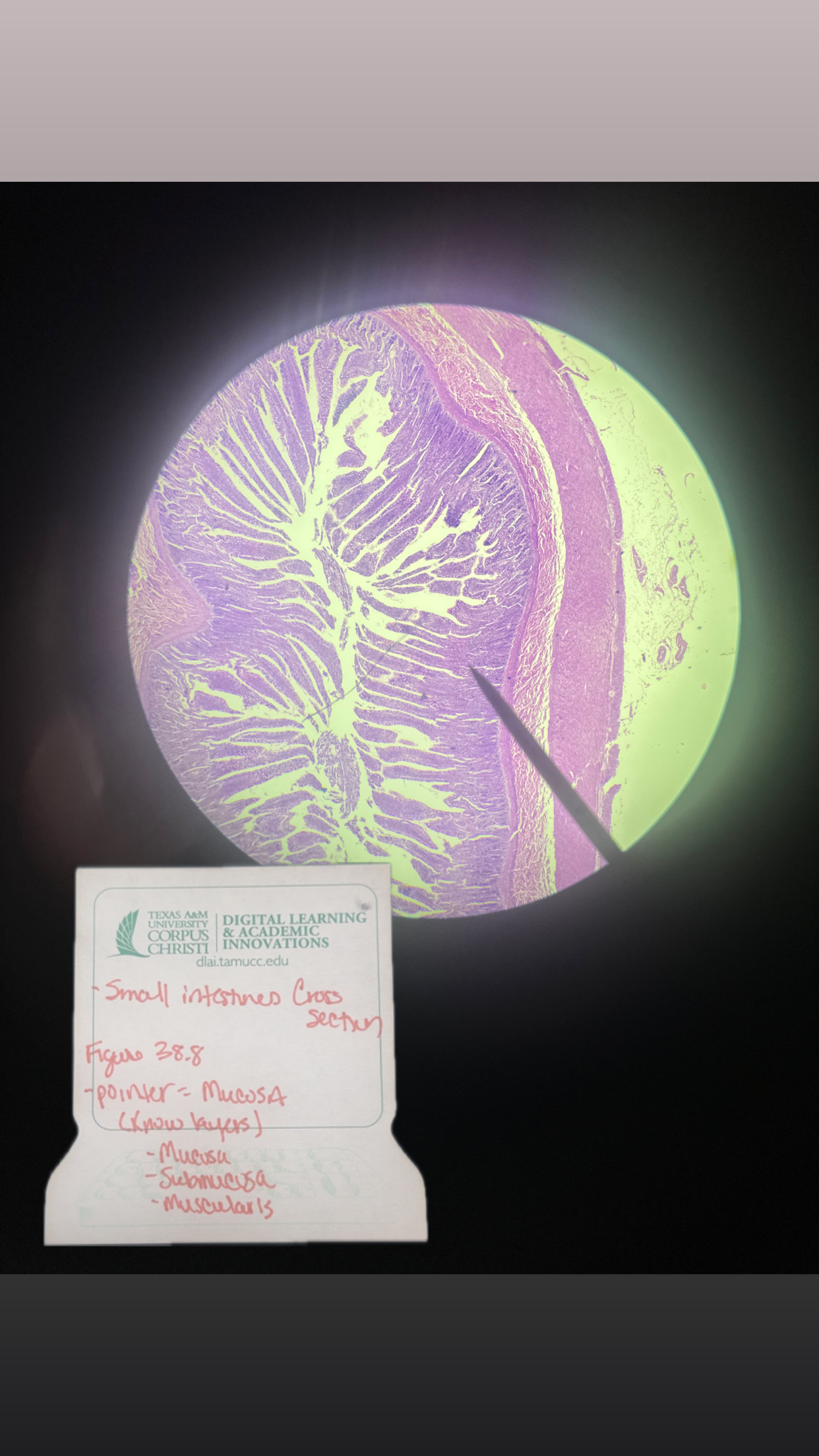 <p>SMALL INTESTINE CROSS SECTUM</p>