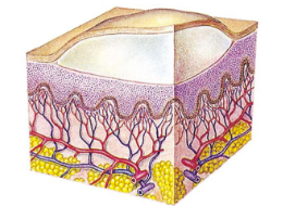 <ul><li><p>circumscribed</p></li><li><p>elevated</p></li><li><p>contains serous fluid</p></li><li><p>>5mm diameter</p></li><li><p>ex) blister</p></li></ul><p></p>