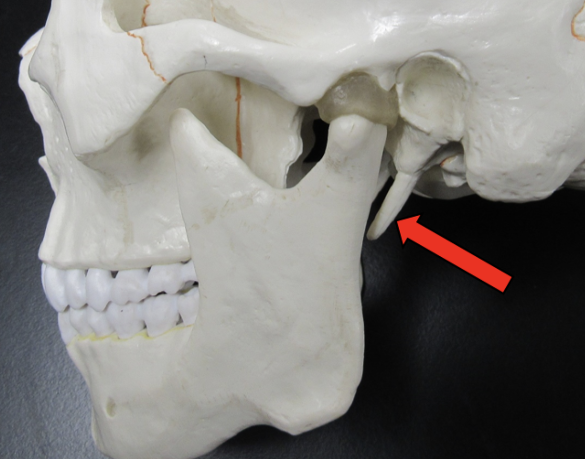 <p><span><strong>Identify the bone marking indicated by the pointer.</strong></span></p>
