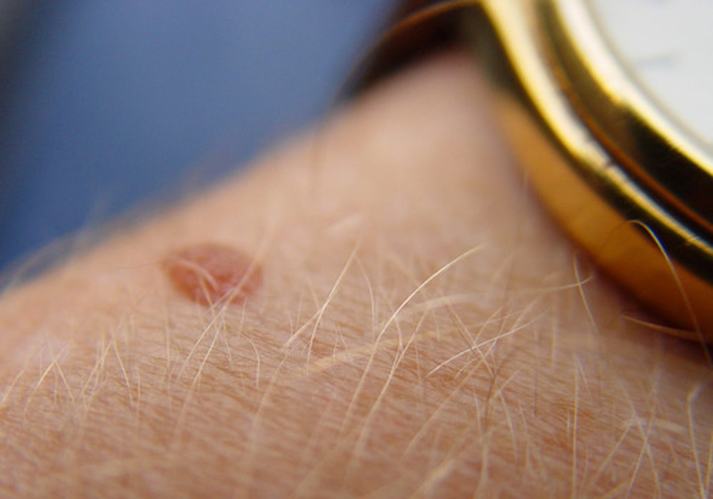 <p>It is a small brownish on the skin, ranging in color from pale tan to brown or bluish-black.</p>