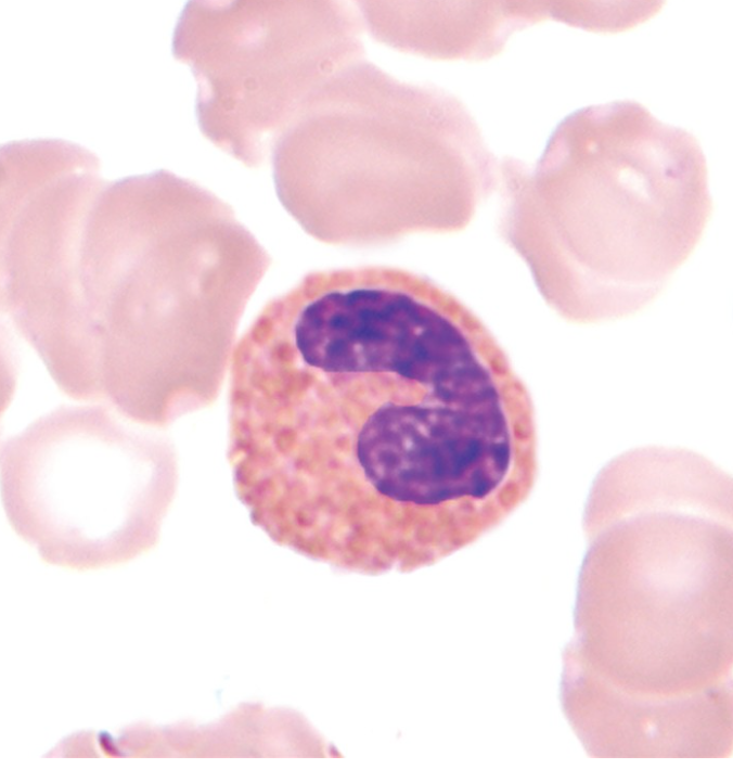 <p>What WBC precursor is this?</p>