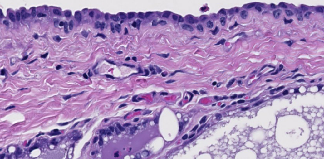 <p>ID the type of CT below the stratified cuboidal epithelium</p>