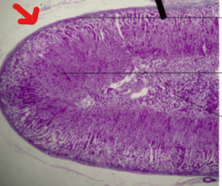 <p>What is the arrow pointing to?</p>