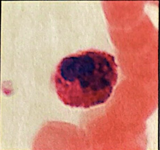 <p>eosihophilis (granulocyte) </p>