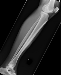 <p>What is the error in this lateral leg X-ray? How should it be corrected?</p>