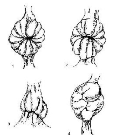 <p>What happens to the mare cervix and vagina during ovulation (estrogen peak)</p><p>Match the number to the time in cycle </p>