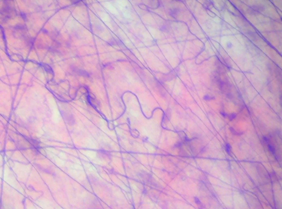 <p><span>Identify the tissue in the micrograph.</span></p>