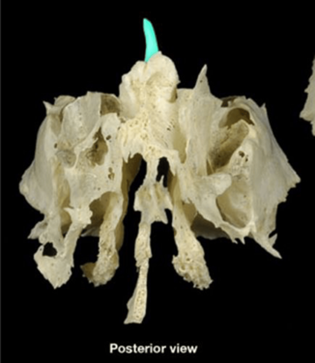 <p>What is this boney feature?</p>
