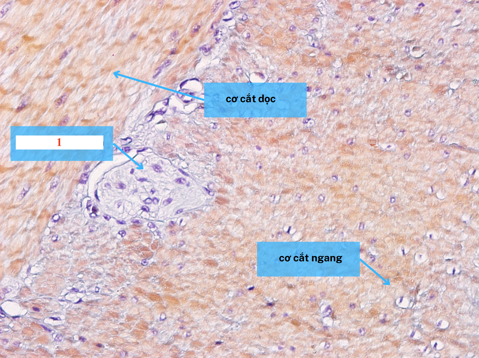 <p>Cấu trúc gì ?</p>