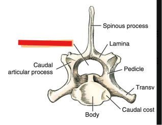 <p>Q: Vertebral Arch: …… - all the vertebral foramina concur to form the vertebral canal. </p><p>A. intervertebral discs </p><p>B. transverse foramina </p><p>C. articular processes </p><p>D. Vertebral foramen</p>