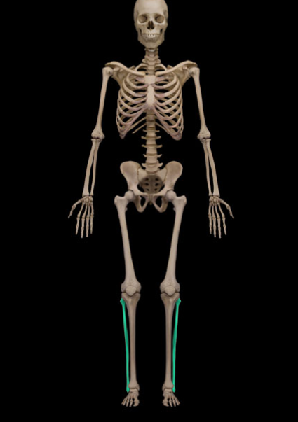 <p>What is the name of this bone?</p>