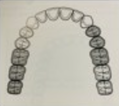 <p>What kennedy classification?</p>