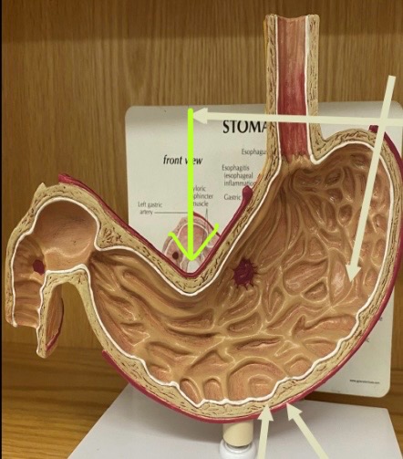 term image