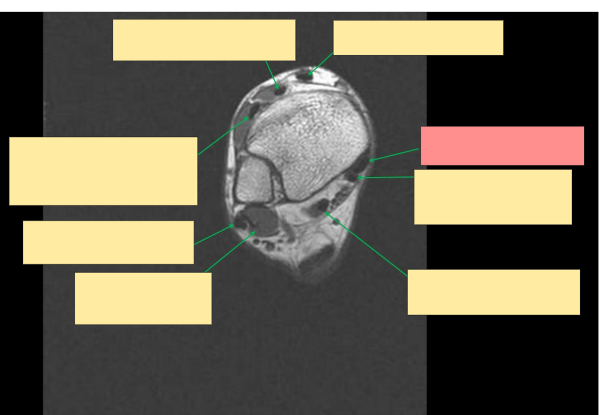 <p>Identify this structure </p>